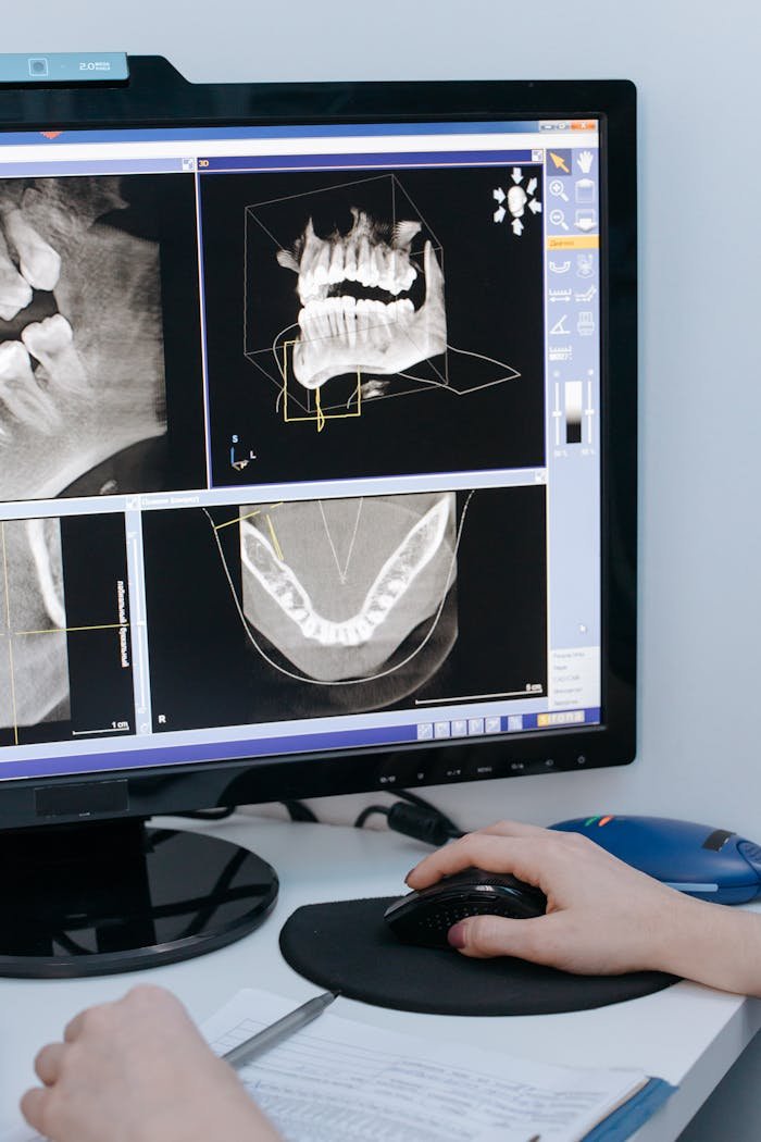 Dental exam ct scan