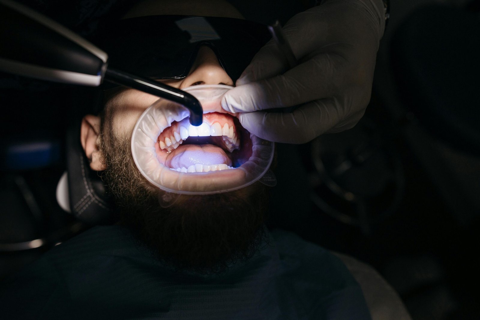 Close-up of dentist using ultraviolet light on a patient's teeth.